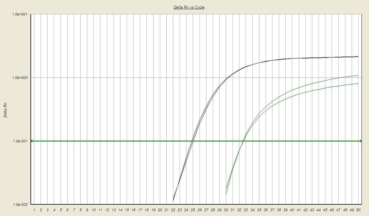 Post treatment quantitative real time PCR at the time of disease relapse detects b2-b3 type BCR-ABL1 transcripts (green-colored amplification curves) with a BCR-ABL1/ABL1 ratio of 0.0075 